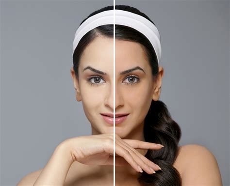 How To Treat Uneven Skin Tone Naturally Learn More About How To Get Even Skin Tone Raenaru