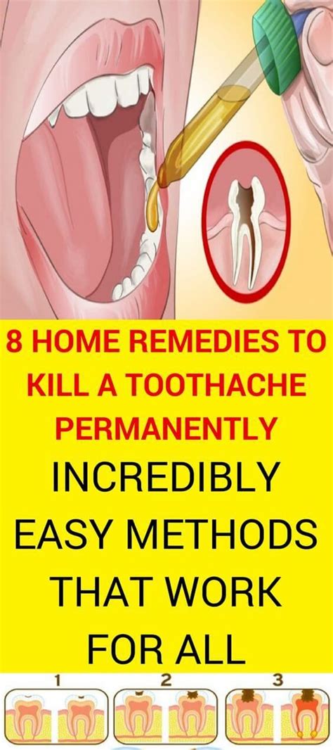 Pain Relief 8 Home Remedies To Kill A Toothache Permanently
