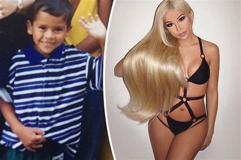 Transgender Model Transitions Into Human Barbie After Plastic Surgery ‘i Wanted The Pain