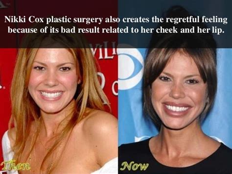Nikki Cox Plastic Surgery