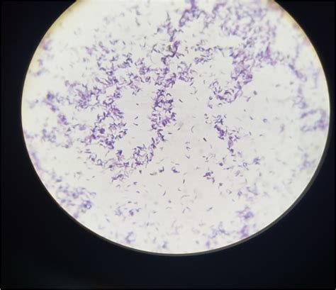Figure 2 Under Microscope Gram Stain Gram Positive Bacilli