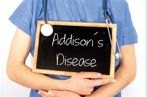 Understanding Addisons Disease Causes Symptoms And Treatment
