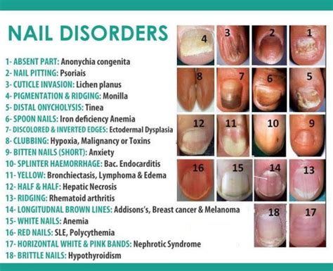 Fingernail Color And Clues To Your Healthpositivemed Where Positive