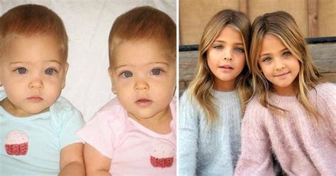 These Twin Sisters Have Grown Up To Be The Most Beautiful Twins In The