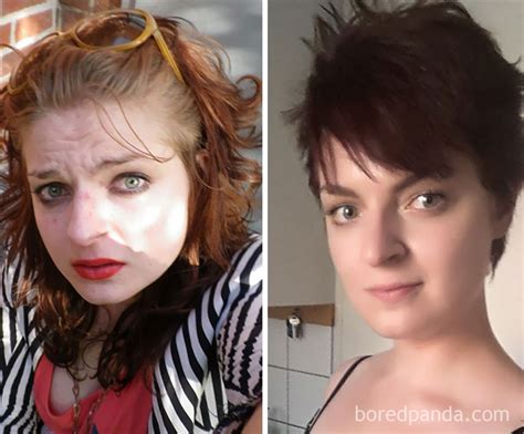 And the drug hasn't caused any permanent change. These Before-And-After Photos Show What Happens When You Quit Drinking Alcohol