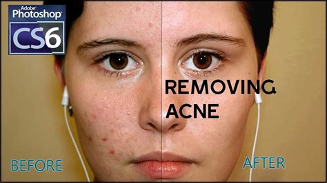 How To Remove Acne In Photoshop Adobe Photoshop Cs6 Tutorial For