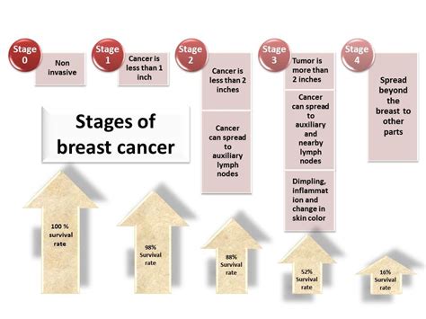 What Is Stage Breast Cancer Symptoms Breastcancertalk Net Hot Sex Picture