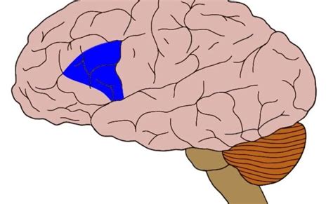 Know Your Brain Aphasia Neuroscientifically Challenged Otosection