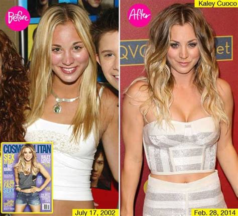 Kaley Cuoco Boob Job Before And After Plastic Surgery Facts