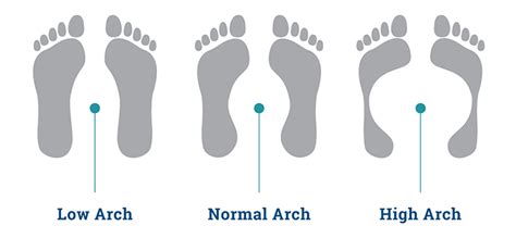 Know Your Arches Your Sole Insole