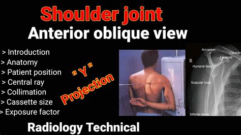 Shoulder Joint Anterior Oblique View Y Projection By Bl Kumawat