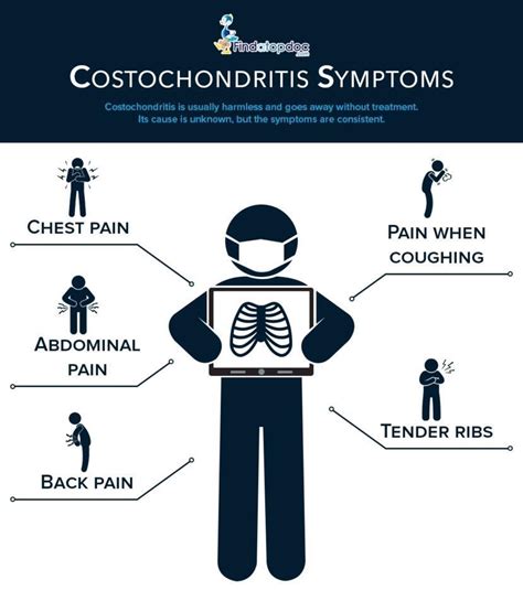 Costochondritis Symptoms Causes Treatment And Diagnosis Findatopdoc