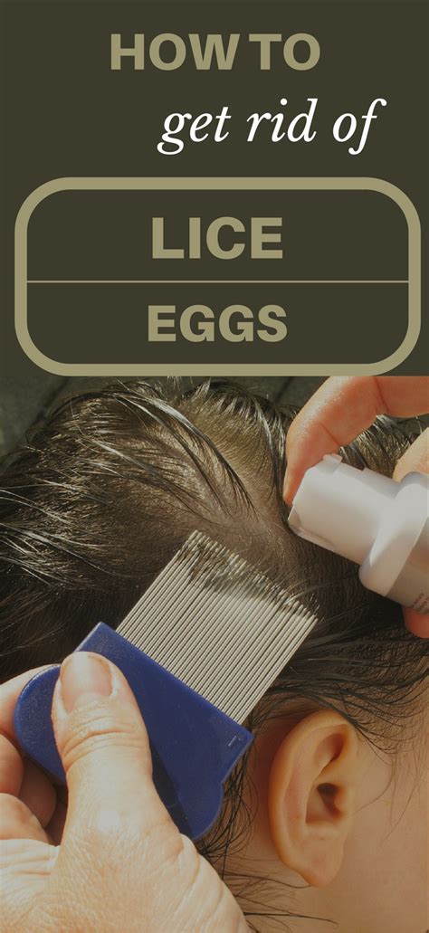 We have been in an egg drought and finally we have so many extra eggs we are not quite sure what to do with them! How To Get Rid Of Lice Eggs - TopCleaningTips.com