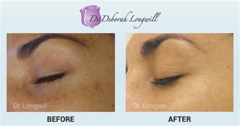 Miami Center For Cosmetic Dermatology Dr Deborah Longwill