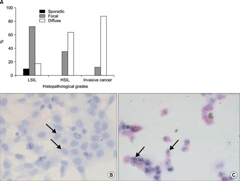 P16 Ink4a Protein Expression In Human Papillomavirus Hpv A P16