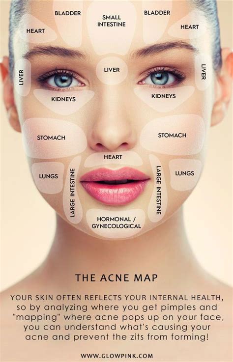 The Acne Face Map Face Mapping Face Mapping Acne Face Acne