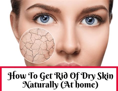 How To Get Rid Of Dry Skin On Face Naturally At Home Trabeauli In