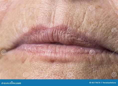 Old Face Stock Photo Image Of Time Surgery Problem 46174676