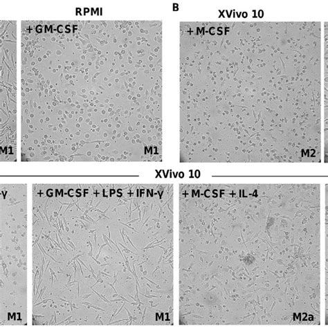 Morphology Of Monocyte Derived Macrophages After 6 Days Download
