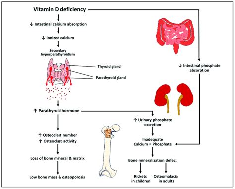 Schematic Representation Of The Pathophysiology Of Vitamin D Deficiency