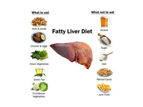 Fatty Liver Diet Foods To Eat And Avoid
