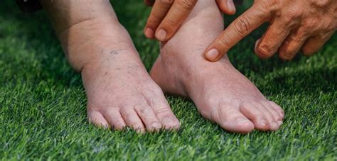 Signs And Symptoms Of Poor Circulation In Feet Palmetto State Podiatry
