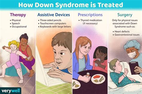 How Down Syndrome Is Treated