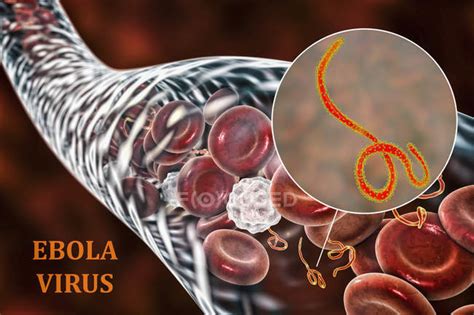 Ebola Virus In Blood And Close Up Of Virions Digital Illustration