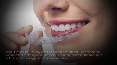 How to fix an overbite in adults. Correct Your Overbite in New Jersey with Invisalign ...