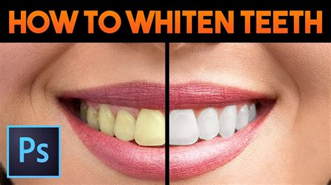 How To Whiten Teeth Easy And Quick│adobe Photoshop Tutorial Youtube