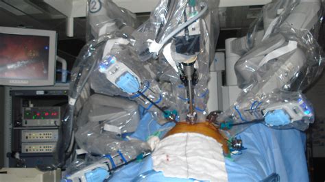 Robot Robotic Radical Prostatectomy Mike Williams Flickr