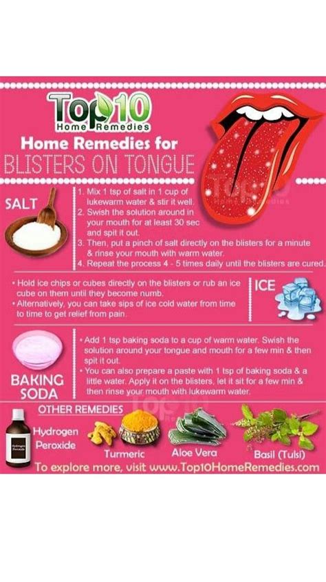 Home Remedies For Blisters On Tongue An Immersive Guide By