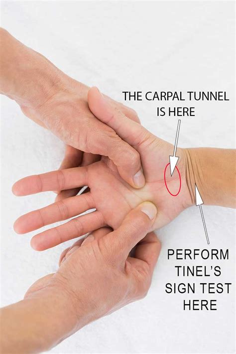 Self Test For Carpal Tunnel The Carpal Solution