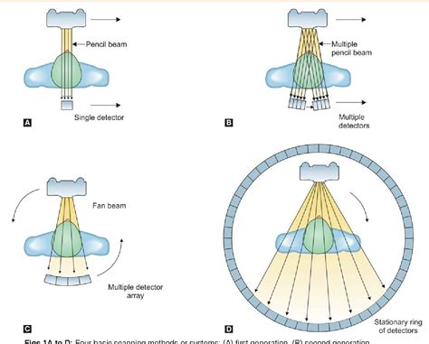 Pdf Comparison Of Spiral Computed Tomography And Cone Beam Computed