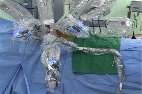Robot Assisted Endoscopic Thyroidectomy For Thyroid Malignancies Using