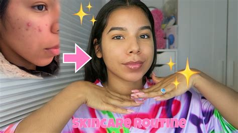How I Cleared My Acne Skincare Routine Youtube