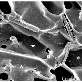 Cryo Scanning Electron Microscopy Cryo Sem Micrograph At Higher