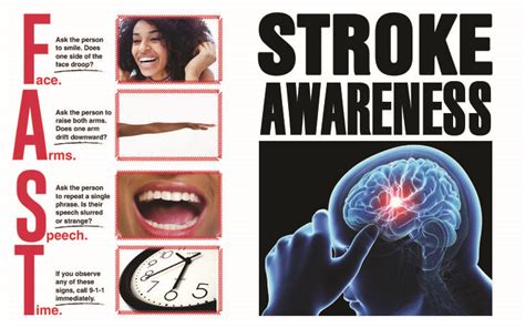 Understand the types of strokes, how they happen, and their symptoms. Learning 'FAST' Response to Stroke Urged by American Heart ...