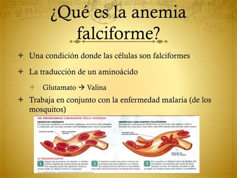 Ppt La Anemia Falciforme Powerpoint Presentation Id6399241