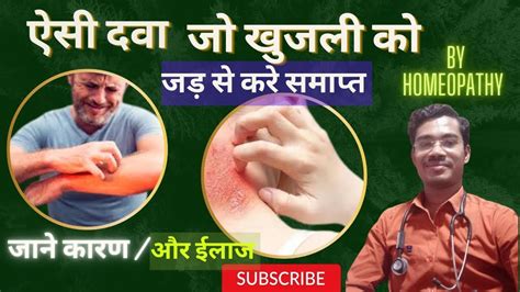 Homeopathic Medicine For Itching Itching Itching Problem Solution