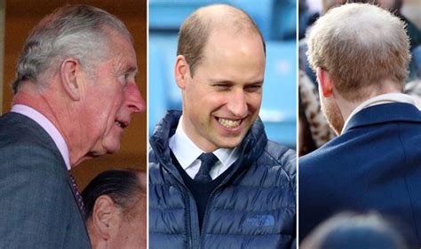 Why Are Prince Harry And William Going Bald What Can You Do To Prevent