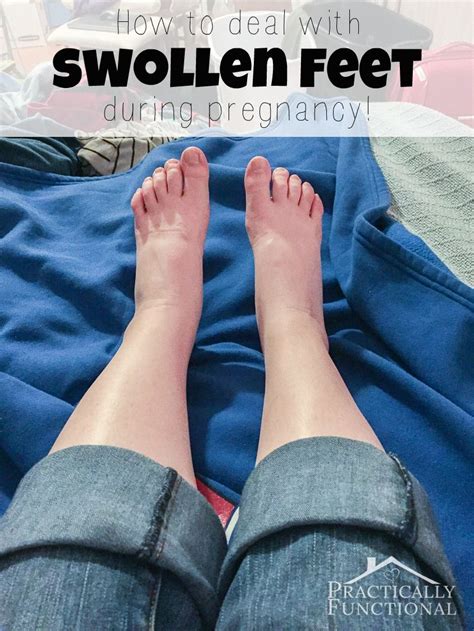 dealing with swollen feet during pregnancy practically functional swollen feet foot