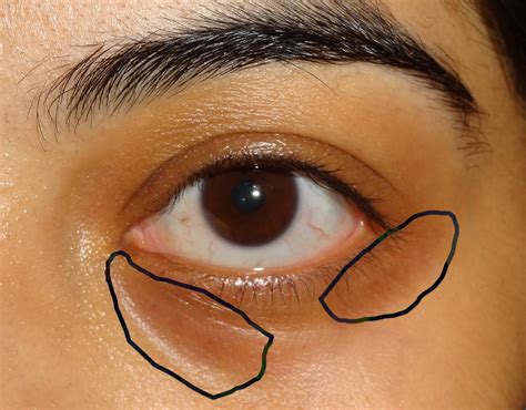 How To Apply Concealer To Under Eye Circles Tutorial