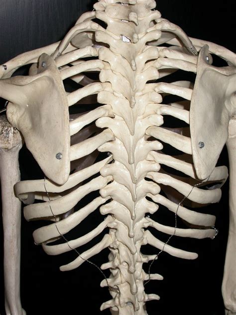 Anatomy Bones Human Anatomy Punk Fashion Diy Fashion Spinal Surgery Human Bones