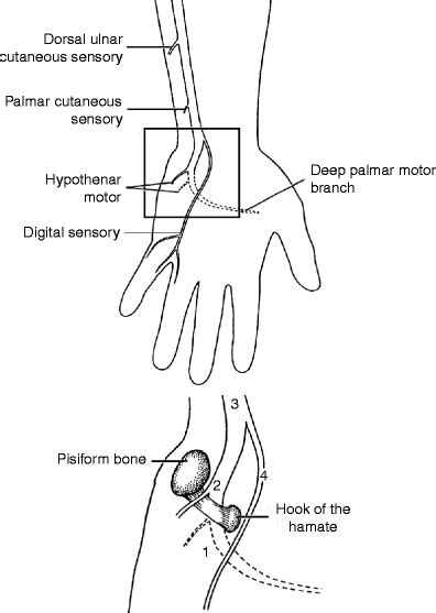 Compressive And Entrapment Neuropathies Of The Upper Extremity