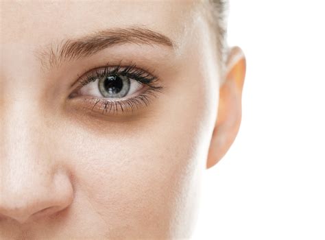 Beauty Causes Of Under Eye Dark Circles And How Antiaging Eye Cream