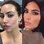 Kim Kardashian Opens Up About Struggling With Psoriasis Flare Ups 