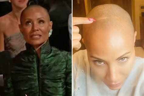 Inside Jada Pinkett Smiths Heartbreaking Alopecia Battle Before Will
