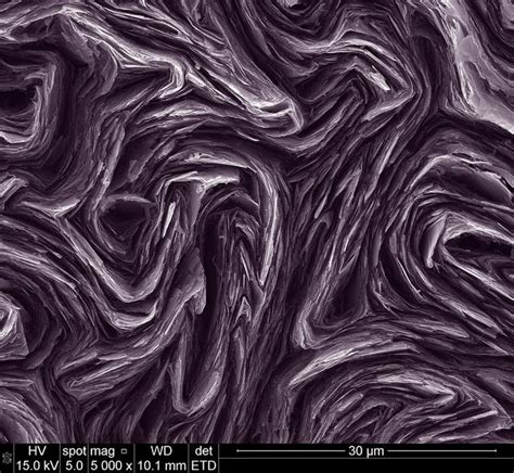 Photos The 2012 Fei Electron Microscope Photo Contest Things Under A