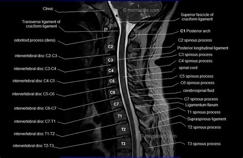 C Spine Anatomy Mri Cervical Spine Sagittal Anatomy